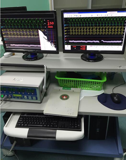 经心内心脏电生理检查