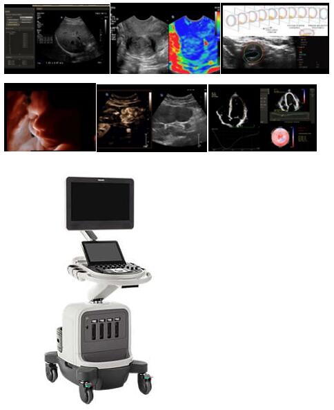 飞利浦Affiniti70 全身应用超声诊断系统
